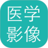 医学影像